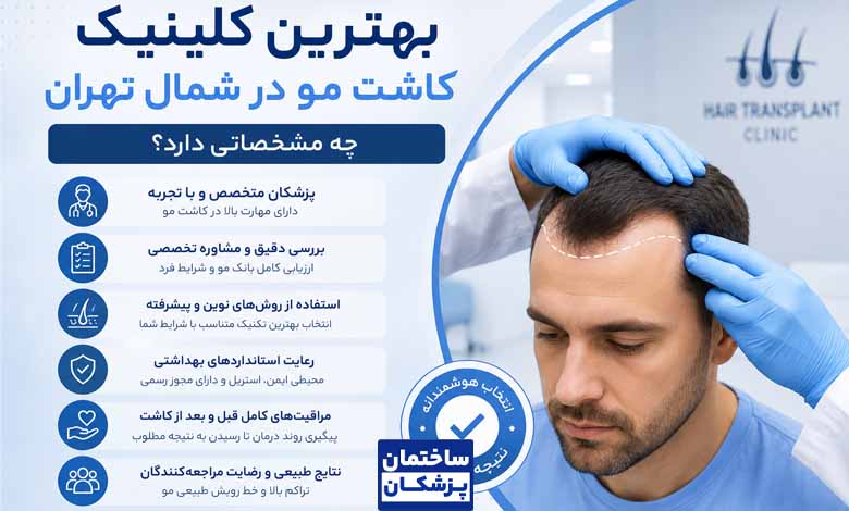 بهترین کلینیک کاشت مو در شمال تهران چه مشخصاتی دارد؟