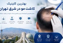 معرفی بهترین کلینیک کاشت مو در شرق تهران