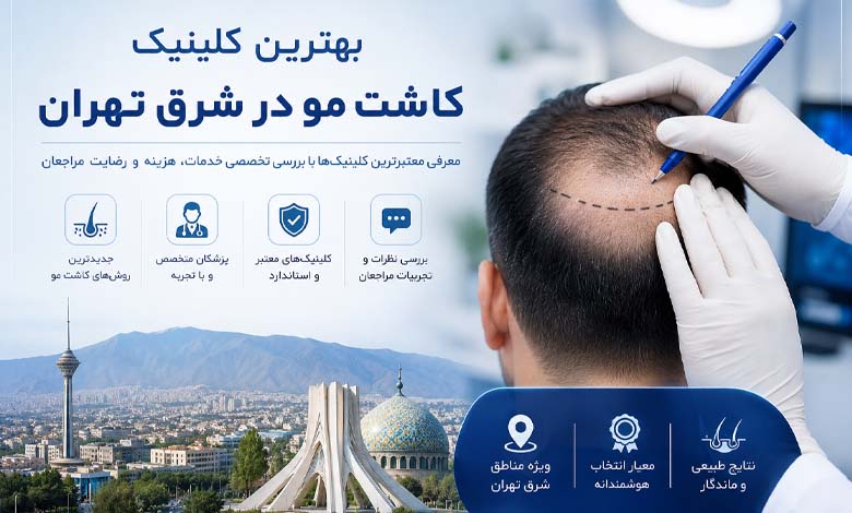 معرفی بهترین کلینیک کاشت مو در شرق تهران