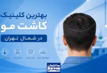 بهترین کلینیک کاشت مو در شمال تهران