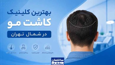 بهترین کلینیک کاشت مو در شمال تهران