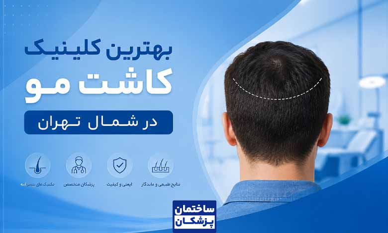 بهترین کلینیک کاشت مو در شمال تهران