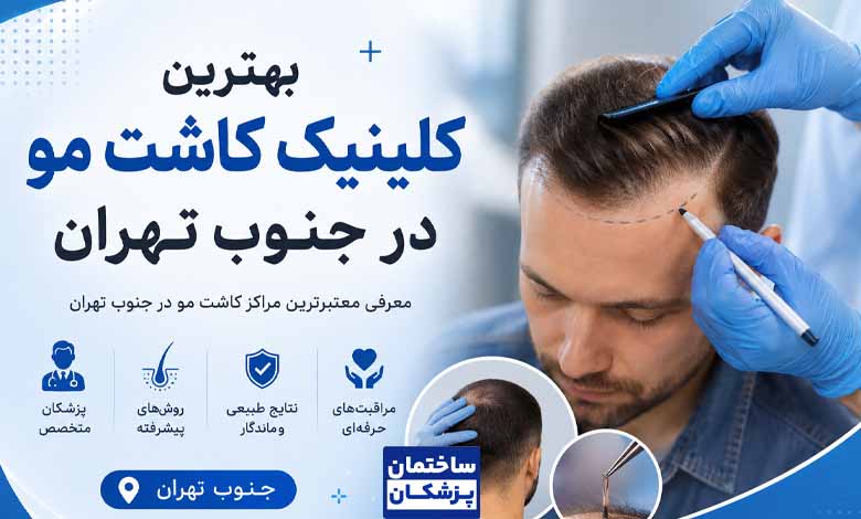 معرفی بهترین کلینیک کاشت مو در جنوب تهران