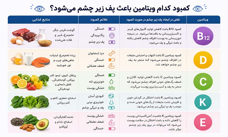 کمبود ویتامینهایی که باعث ایجاد پف زیر چشم میشود
