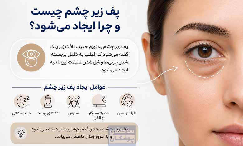 پف زیر چشم چرا ایجاد میشود