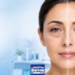 قیمت و هزینه بلفاروپلاستی