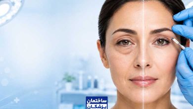 قیمت و هزینه بلفاروپلاستی