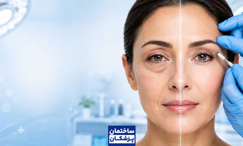قیمت و هزینه بلفاروپلاستی