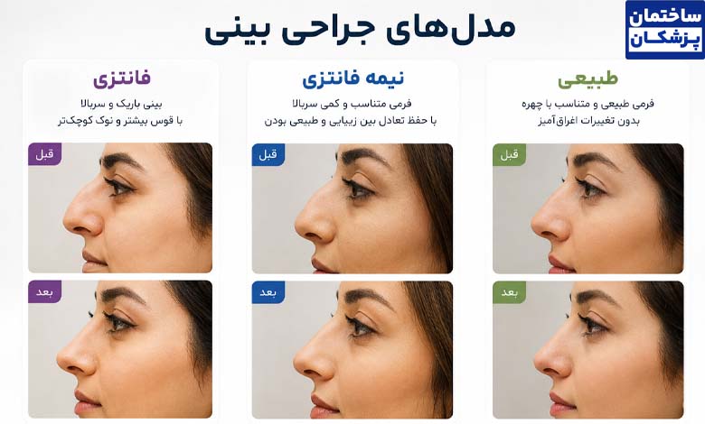 مدل‌های مختلف عمل بینی در سعادت آباد تهران