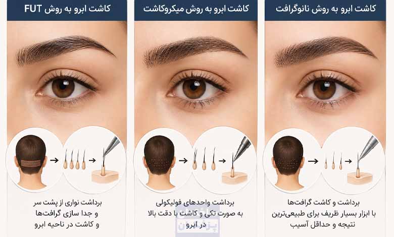 قیمت کاشت ابرو به روشهای مختلف
