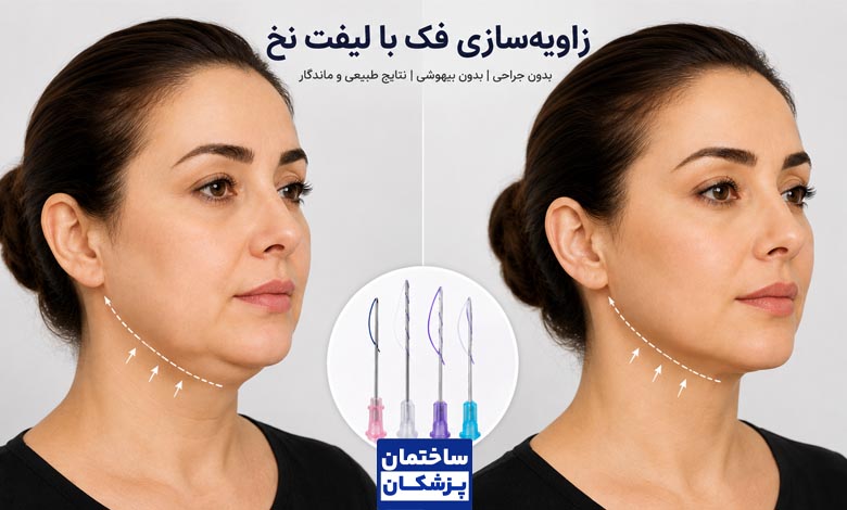 زاویه سازی صورت با لیفت با نخ