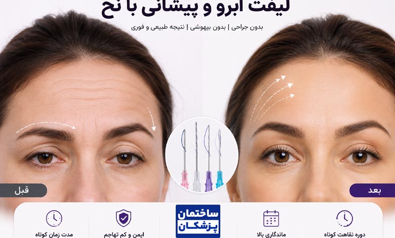 لیفت پیشانی و ابرو با نخ