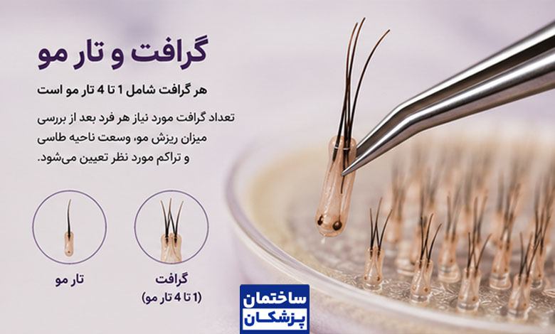 قیمت کاشت هر گرافت تار مو