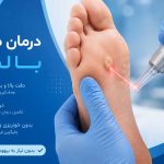 هزینه درمان میخچه با لیزر