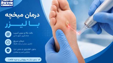 هزینه درمان میخچه با لیزر