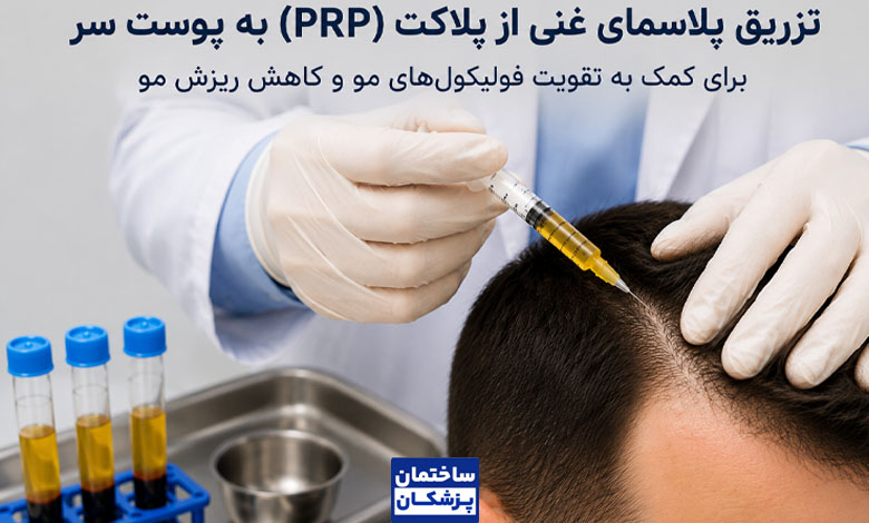 آماده سازی پلاسمای غنی از پلاکت برای پی آر پی مو