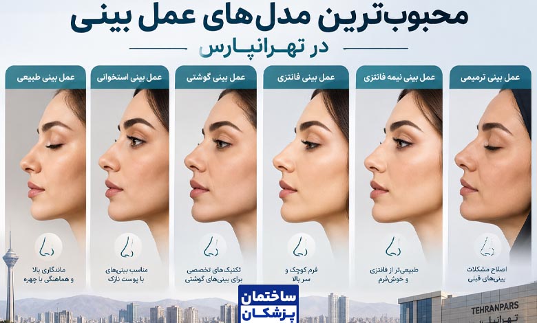مدلهای محبوب عمل بینی در تهرانپارس