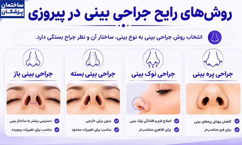 روشهای رایج جراحی بینی در پیروزی