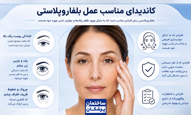 کاندیدای مناسب بلفاروپلاستی چه کسانی هستند؟