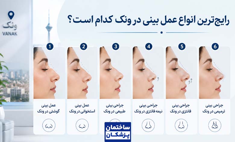 رایجترین انواع عمل بینی در ونک کدام است؟