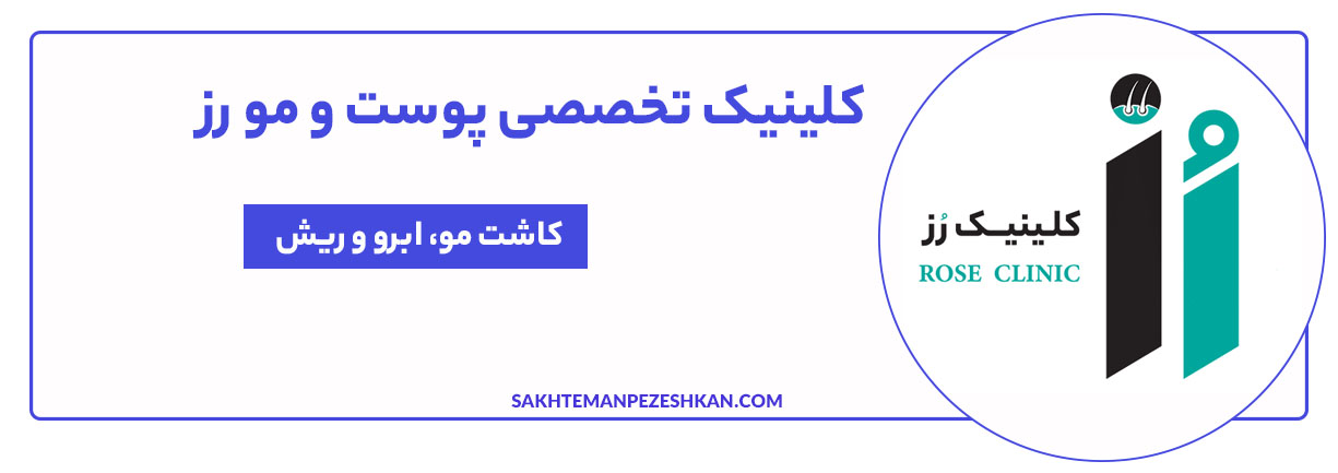 کلینیک تخصصی پوست و مو رز در طول ۱۶ سال فعالیت، بیش از ۲۰ هزار کاشت موفق انجام داده است.